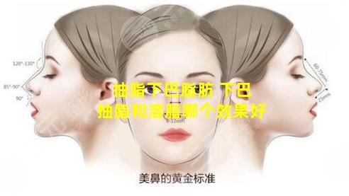 抽脂下巴脂肪 下巴抽脂和溶脂哪个效果好
